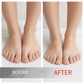 🔥Christmas Limited-Time Offer: 50% OFF!!!🔥Nail Repair Essence for Damaged Nails