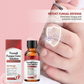 🔥Christmas Limited-Time Offer: 50% OFF!!!🔥Nail Repair Essence for Damaged Nails