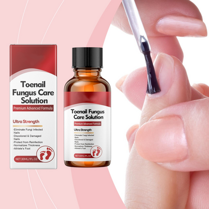🔥Christmas Limited-Time Offer: 50% OFF!!!🔥Nail Repair Essence for Damaged Nails