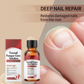 🔥Christmas Limited-Time Offer: 50% OFF!!!🔥Nail Repair Essence for Damaged Nails