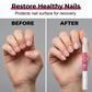 ✨✨Prevenção do hábito de roer unhas em crianças e adultos